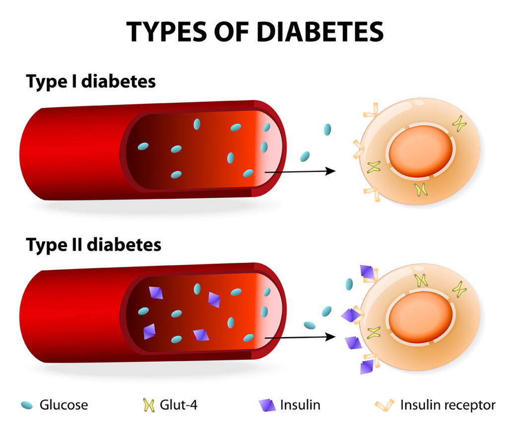 diabetes-mellitus-homeopathic-treatment-consultation-online-gurgaon